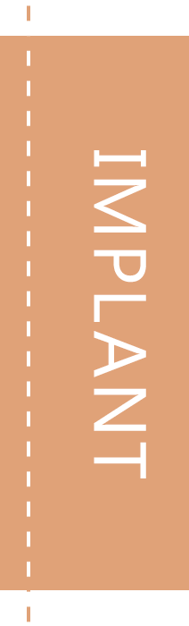 Implant