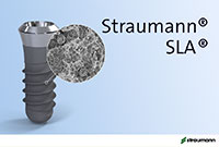 ITIインプラント